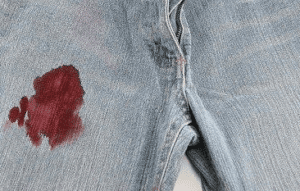 How to Remove Fresh Blood Stains from Jeans: A Step-by-Step Guide
