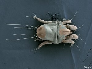 The Invisible Invaders: What Dust Mites Really Look Like